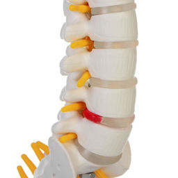 Макет "Поясничный отдел позвоночника" 18*12*8см