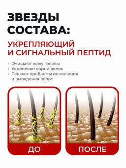 KANS Шампунь для жирных волос и кожи головы, Scalp Oil-controlling Shampoo 500 г  фото 4