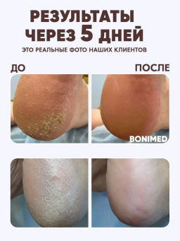 Крем от сухости и трещин на ступнях Bonimed, 125 мл Boni-0102