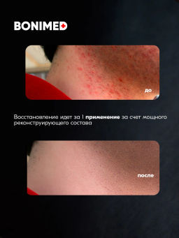 Крем для лица мужской от раздрожения и сухости , 100 г Boni-0142 - Bonimed фото 3
