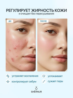 Тоник себорегулирующий для жирной и проблемной кожи лица, 150 мл - SHERNUR фото 3