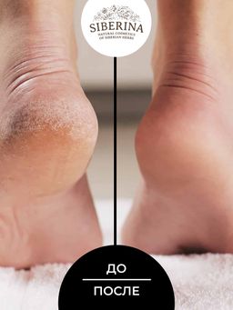 Средство Жидкая пемза для удаления сильно огрубевшей кожи, трещин, мозолей и натоптышей - Siberina фото 7