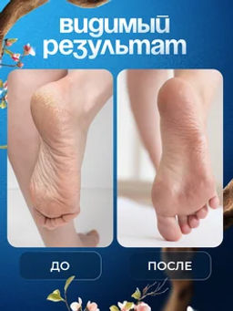 Карандаш-стик для рук и ног против трещин авокадо - Sadoer фото 4