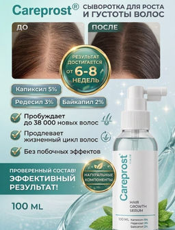 Careprost для ВОЛОС