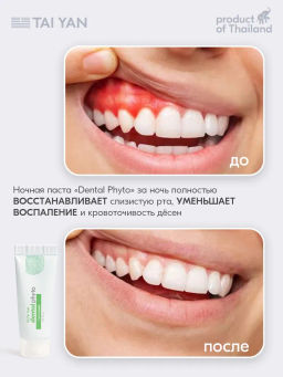 Тревел набор зубных паст 2*10 гр, 111-06 - Bonimed фото 7