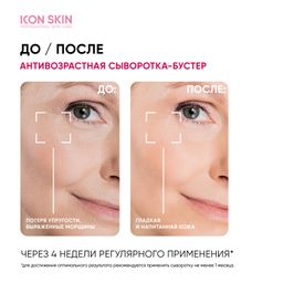 Антивозрастная сыворотка-концентрат Lift Up с коллагеном - Icon skin фото 5