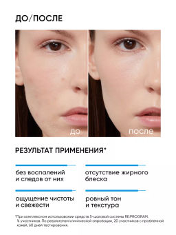 Гель эмульсия энзимная от акне и воспалений - Icon skin фото 3