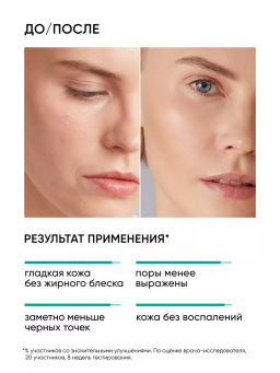 15% AHA+BHA пилинг для лица - Icon skin фото 3