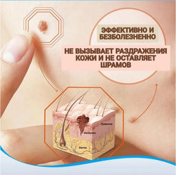 Крем для удаления бородавок, родинок и папиллом, 20 г