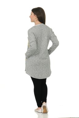 Туника Жемчужина - Марлен фото 3