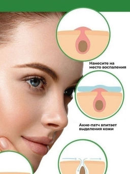 Трехступенчатая система очистки пор от черных точек - Bioaqua фото 12