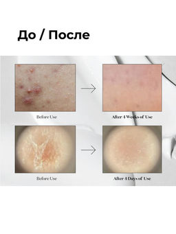 VT Cosmetics Бустер-сыворотка для лица с микроиглами и экстрактом центеллы азиатской / Reedle Shot 100, 50 мл