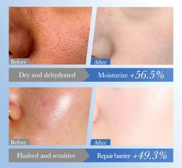 FAYANKOU Сыворотка увлажняющая для лица Hyaluronan, 30мл. - Sadoer фото 6