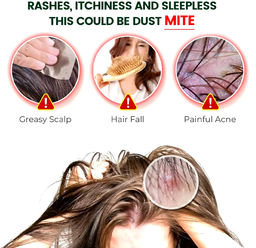 Мазь Aopen от подкожных клещей и вшей для людей и животных 20 мл  фото 3