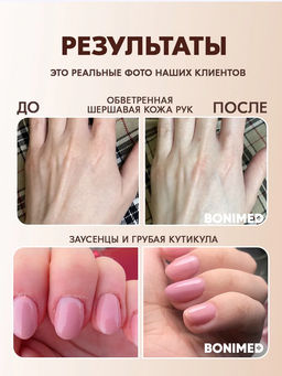 Крем от трещин, сухости и шелушений BONIMED REHABER, 100 гр  фото 10