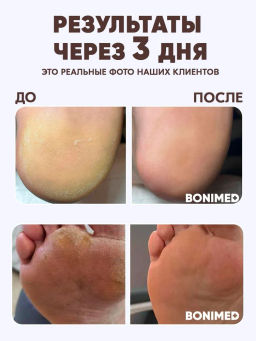 Крем от сухости и трещин на ступнях Bonimed, 125 мл Boni-0102