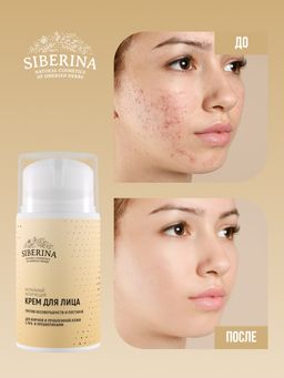 Матирующий крем для лица против несовершенств и постакне для жирной и проблемной кожи с про- и пребиотиками - Siberina фото 7