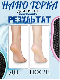 Пемза для ног нового поколения,НАНО Терка для пяток СИРЕНЕВАЯ - Buro фото 2
