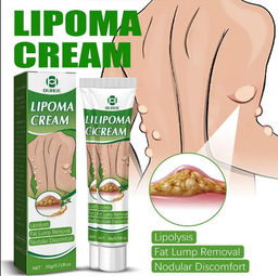 Крем Lipoma для удаления опухолей, средство для удаления отеков кожи, нодулярного дискомфорта, лечения липолиза, крем для удаления жира