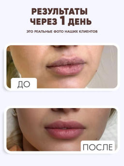 Бальзам для губ от трещин Bonimed, 2,6 г, Boni-0107