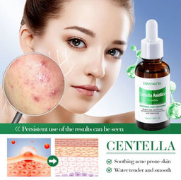 FAYANKOU Сыворотка для лица увлажняющая от прыщей и акне Centella Asiatica, 30мл.