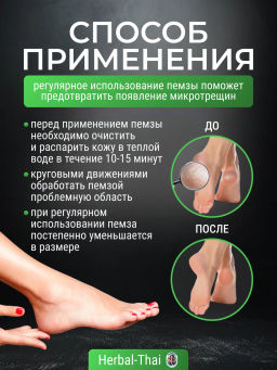 Пемза Тайская д/педикюра 1 шт (цвет в ассортименте) - OTOP фото 17