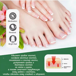 Крем для лечения грибка ногтей 30гр - Buro фото 3