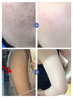 Крем для тела с мочевиной и витамином Е, 100 мл - Baizton фото 3