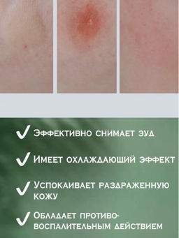 Бальзам после укусов насекомых - Aichun фото 4