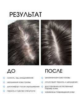 System 4 Терапевтический лосьон М, 150 мл - Sim sensitive фото 3
