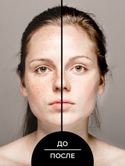 Моментально отбеливающий крем для лица дневной с SPF 10 против веснушек, пигментных пятен и постакне SIBERINA