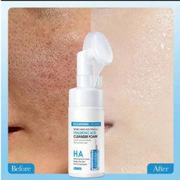 Гель с гиалуроновой кислотой 100мл