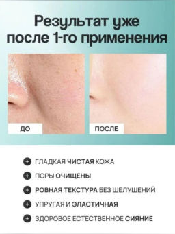 Пептидный гель для умывания с олигопептидом VEZE, 60 г FZ56394  фото 5