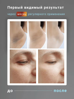 Крем Отбеливающий для Интимных Зон COCO BLUES 5 гр - Тайская Лавка фото 7