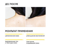 Обновляющий крем для тела с кислотами SKIN RENEWAL, 200 мл ICON SKIN  фото 2