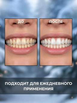 Шок - цена до 04/12 Отбеливающая зубная паста без фтора для зубов - Sadoer фото 4