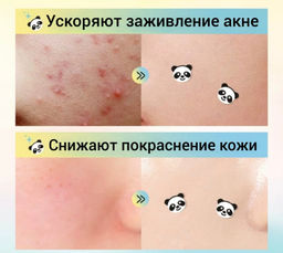 SADOER Гидроколлоидные патчи от прыщей, панда, 40шт