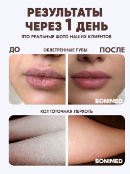 Крем профессиональный от сухости и трещин Bonimed 500 мл Boni-0108  фото 6