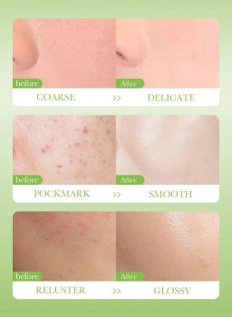 Глина косметическая Осветление Для проблемной кожи - Handaiyan фото 3