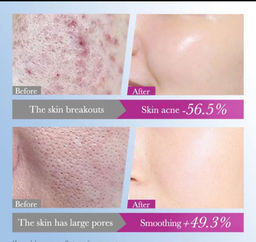 FAYANKOU Сыворотка для проблемной кожи лица 30мл - Sadoer фото 7