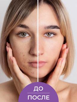 Тоник для лица противовоспалительный 200 мл SIBERINA