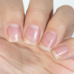 Сыворотка Антифунгал Органик с Тимолом, 6,5 мл - Masura фото 2