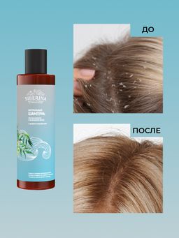 Шампунь "Против перхоти и выпадения волос" с цинком и маслом ним SIBERINA