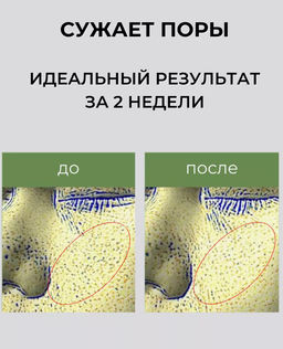 KAINE Сыворотка ночная противовоспалительная с розмарином и кислотами Rosemary AHA Night Serum (30 мл)  фото 5