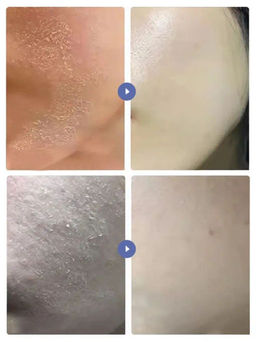 Крем для тела с мочевиной и витамином Е, 100 мл - Baizton фото 2