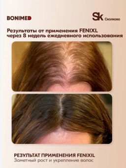 Сыворотка от выпадения и для роста волос FENIXL Boni-0131 - Bonimed фото 3