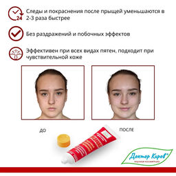 Крем-гель Следоцид, 15мл. - Dr.kirov cosmetic company фото 4