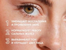 ICON SKIN Косметический набор для лечения акне легкой степени. 4 средства.  фото 3