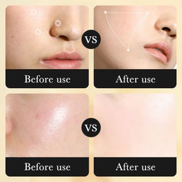 SADOER Пенка для умывания против акне с салициловой и амино кислотами 50г+50г  фото 4