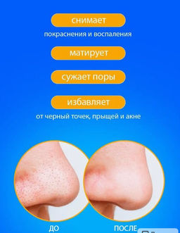 Крем для точечной борьбы с акне и шрамами , 30 гр. - Bioaqua фото 3